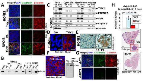 THY1 (CD90) Maintains the Adherens Junctions in Nasopharyngeal ...