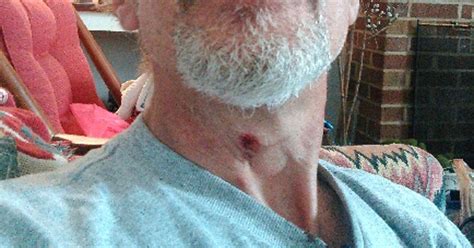 Shooting victim: 'The bullet grazed my Adam's apple'