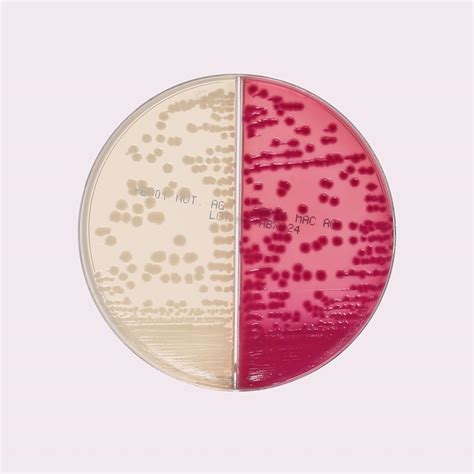 E.coli On Macconkey Agar MacConkey Agar W/0.15% Bile Salts, CV And