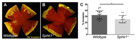 Ablation of Sphingosine Kinase 1 Protects Cornea from ...