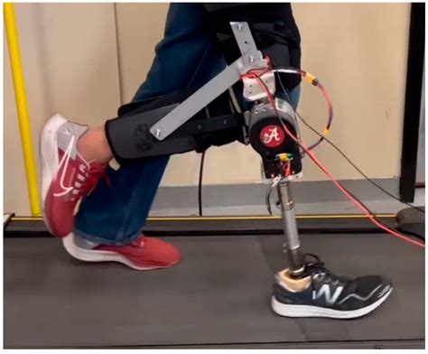 Force-Moment Sensor for Prosthesis Structural Load Measurement