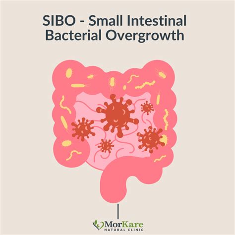 SIBO-Small Intestinal Bacterial Overgrowth - Morkare Natural Clinic