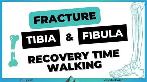 Walking After Broken Tibia and Fibula - Physio'Tips for Recovery