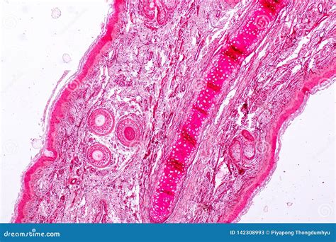 Elastic Cartilage Under Microscope