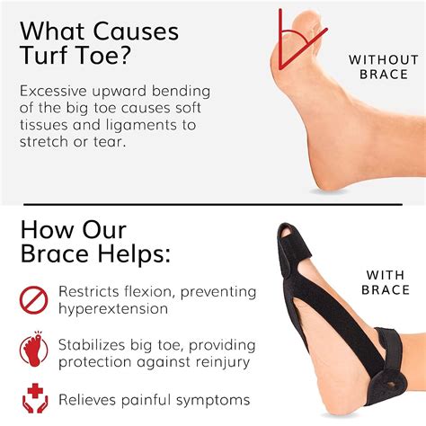 Turf Toe Brace - Adjustable Medical-Grade Orthotic for Big Toe Injury Treatment - Small Size ...