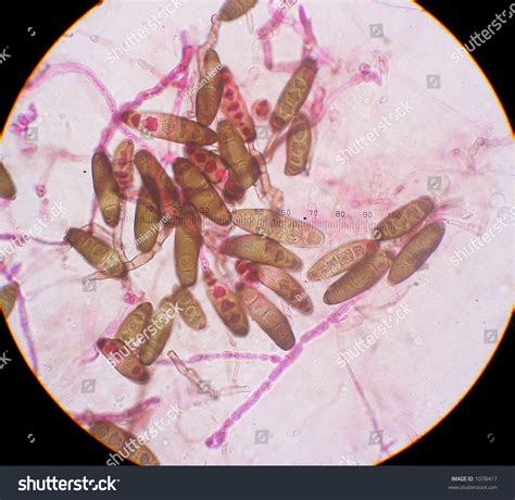 Fungal Spores Under The Microscope (Fungus Causes A Plant Disease) Stock Photo 1078417 ...