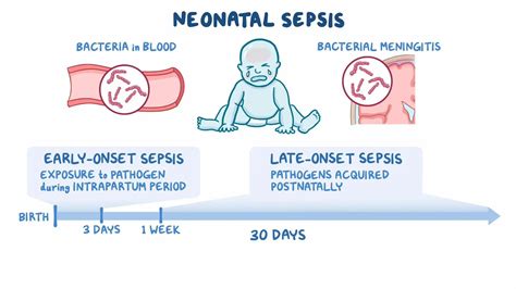 Neonatal sepsis: Nursing: Video & Causes | Osmosis