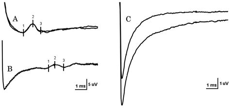 Electrodiagnostic Evaluation of Meralgia Paresthetica