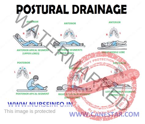 How To Remember Postural Drainage Positions