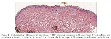 A Double-Blind Randomized Controlled Trial Comparing the Efficacy of 0. ...