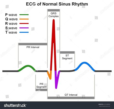 ECG Normal Sinus Rhythm Infographic Diagram Image vectorielle de stock ...