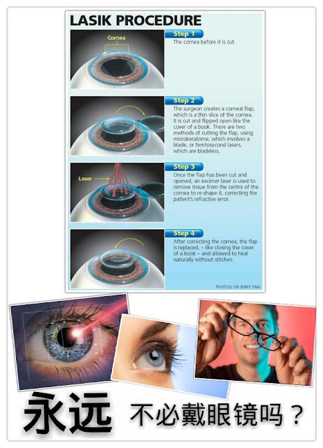 【图】眼睛做激光手术后需注意什么 术后要注意这8点