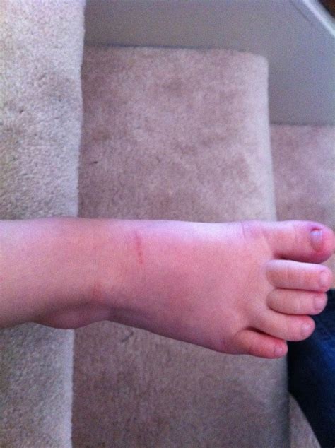 Life is Bella: Dangers of the Deep...and Shallow