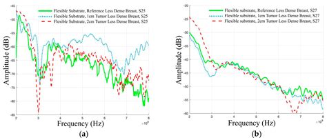 A Breast Tumor Monitoring Vest with Flexible UWB Antennas—A Proof-of ...
