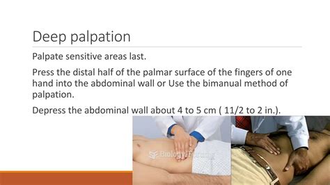The abdominal assessment physical examination | PPTX
