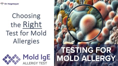Mould Allergy Test