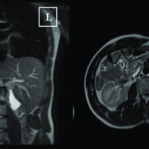 Image result for MRCP Views