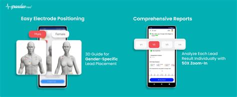 Sunfox Spandan Neo Portable ECG Machine | Home ECG Monitor with 24 ...