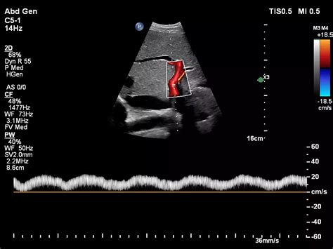 Philips - Affiniti 70 Ultrasound system