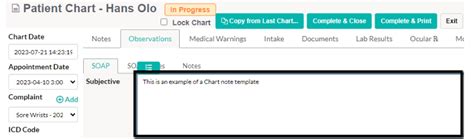Image result for Add Note to Chart