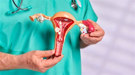 Endometriosis Awareness Month: Know about its signs and symptoms ...