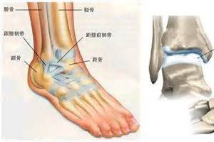 脚踝疼痛肿是什么原因 脚后跟疼痛是什么原因?_第二人生