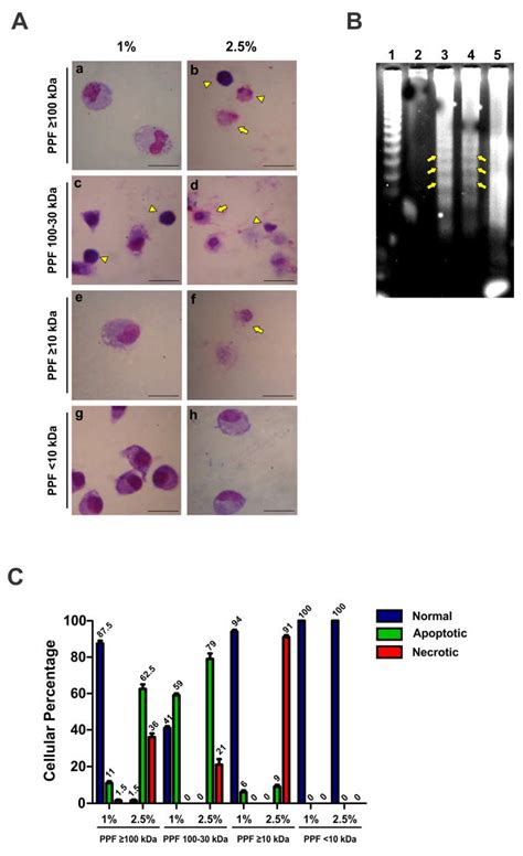 Exotoxins from Clostridium septicum Kill Mouse Peritoneal Macrophages ...