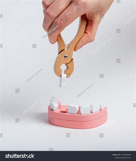 Image result for Wisdom Tooth Decayed