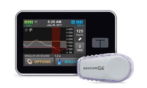 FDA approves Control-IQ artificial pancreas system