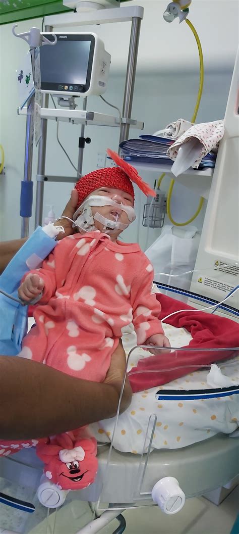 A Trisomy 18 Journey – Grace Chiinsankim Guite (1 months 23 days old)on ...