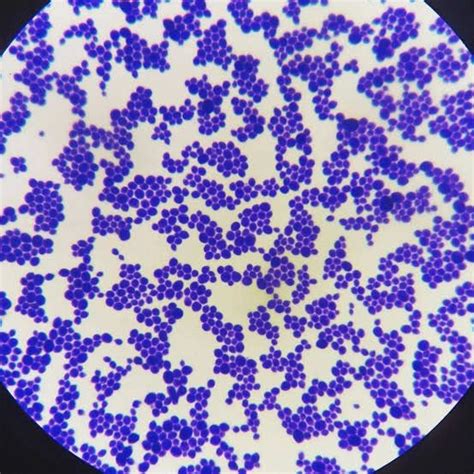 Staphylococcus Aureus Under Microscope 的图像结果