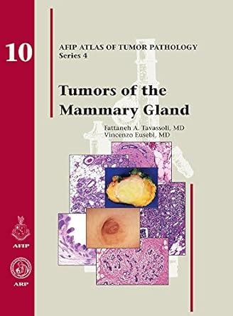 Buy Tumors of the Mammary Gland: 10 (AFIP Atlas of Tumor Pathology ...