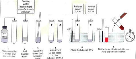 Image result for Prothrombin Time Normal Result