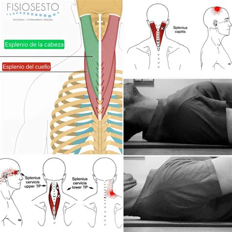 Musculos Del Cuello Se Muestran Los Músculos De La Cabeza Y El Cuello
