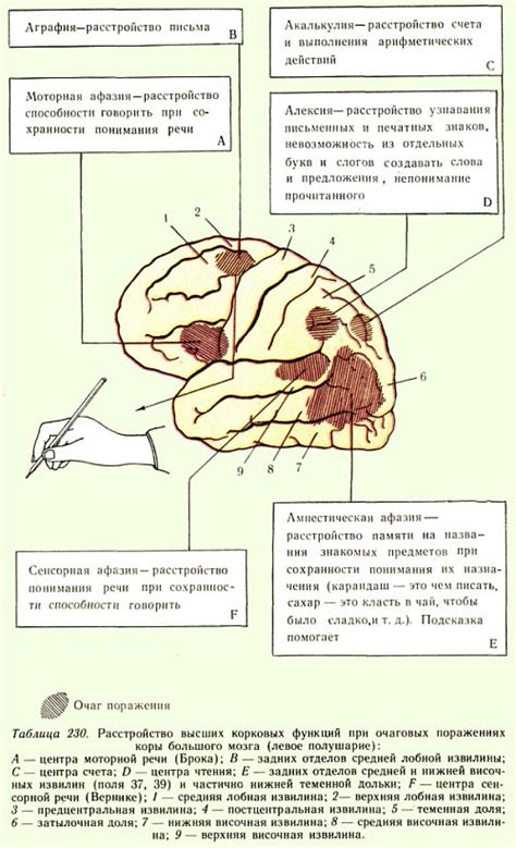 Афферентная моторная афазия