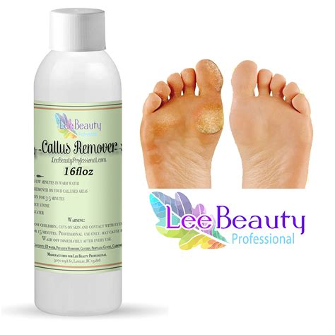 Como Se Usa Liquid Corn & Callus Remover at Vivian Donnelly blog