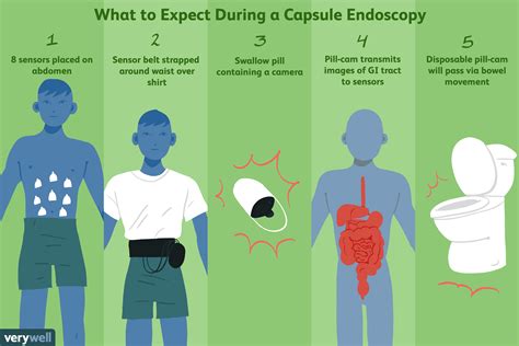 Capsule Endoscopy Uses, Side Effects, and Results