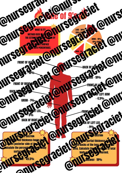 RULE OF 9's Burn Calculation Method - Nursing School Notes - Next Gen ...