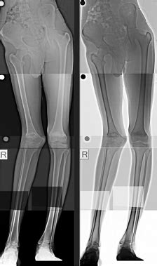 PREM SCANS - Perfect Diagnosis