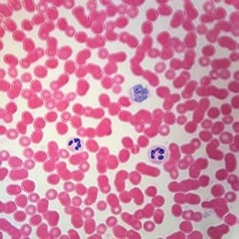 Human Blood Film Slide, Smear, H&E : Amazon.in: Industrial & Scientific