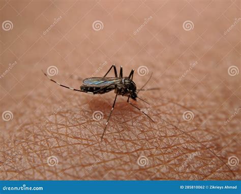 Image result for Insect Removal From Humans