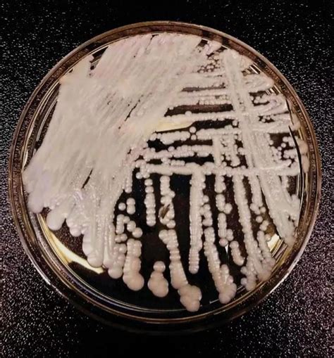 念珠菌显色培养基实验原理-环凯微生物官网