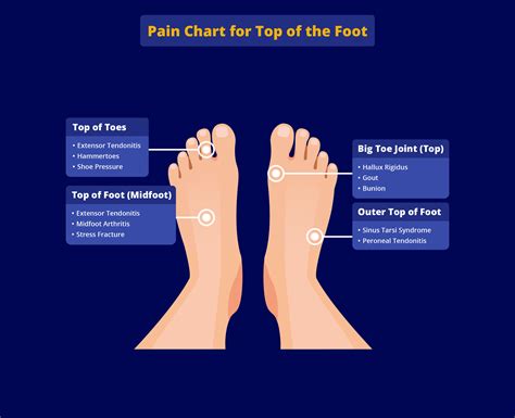 Foot Pain Chart: What Your Pain Location Might Mean