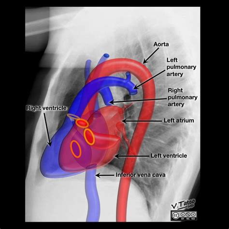 Radiology Quiz 46331 | Radiopaedia.org | Radiology, Radiology imaging, Radiography