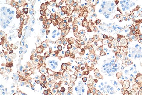 CD206 antibody (81525-1-RR) | Proteintech