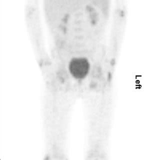 Image result for Maximum Intensity Projection Python