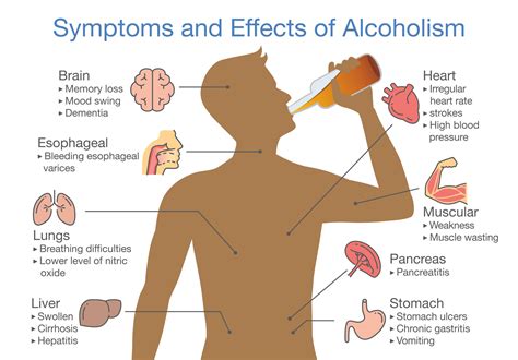 Alcoholism - Rehab Guide