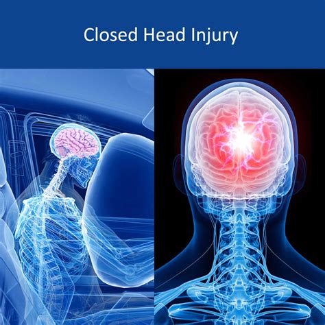 24/7 Tampa Car Accident Lawyers & Personal Injury Attorneys Near You - Local Tampa FL Car ...