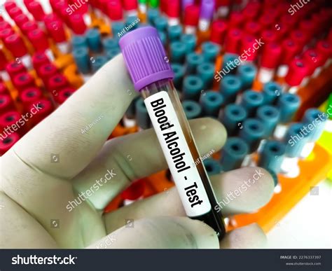 Blood Sample Blood Alcohol Test Medical Stock Photo 2276337397 ...