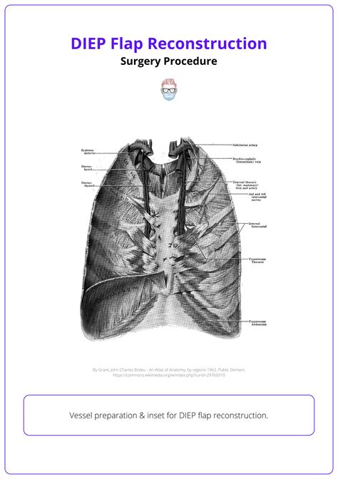 DIEP Flap Reconstruction: Anatomy, Key Surgical Steps, & Complications